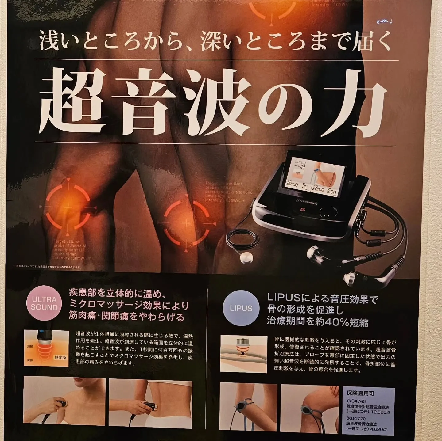 超音波治療『LIPUS 治療』