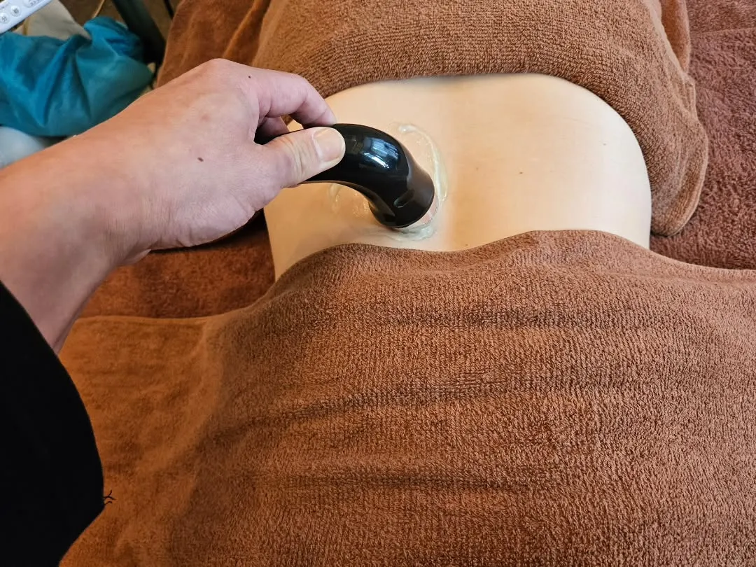 腰の超音波治療