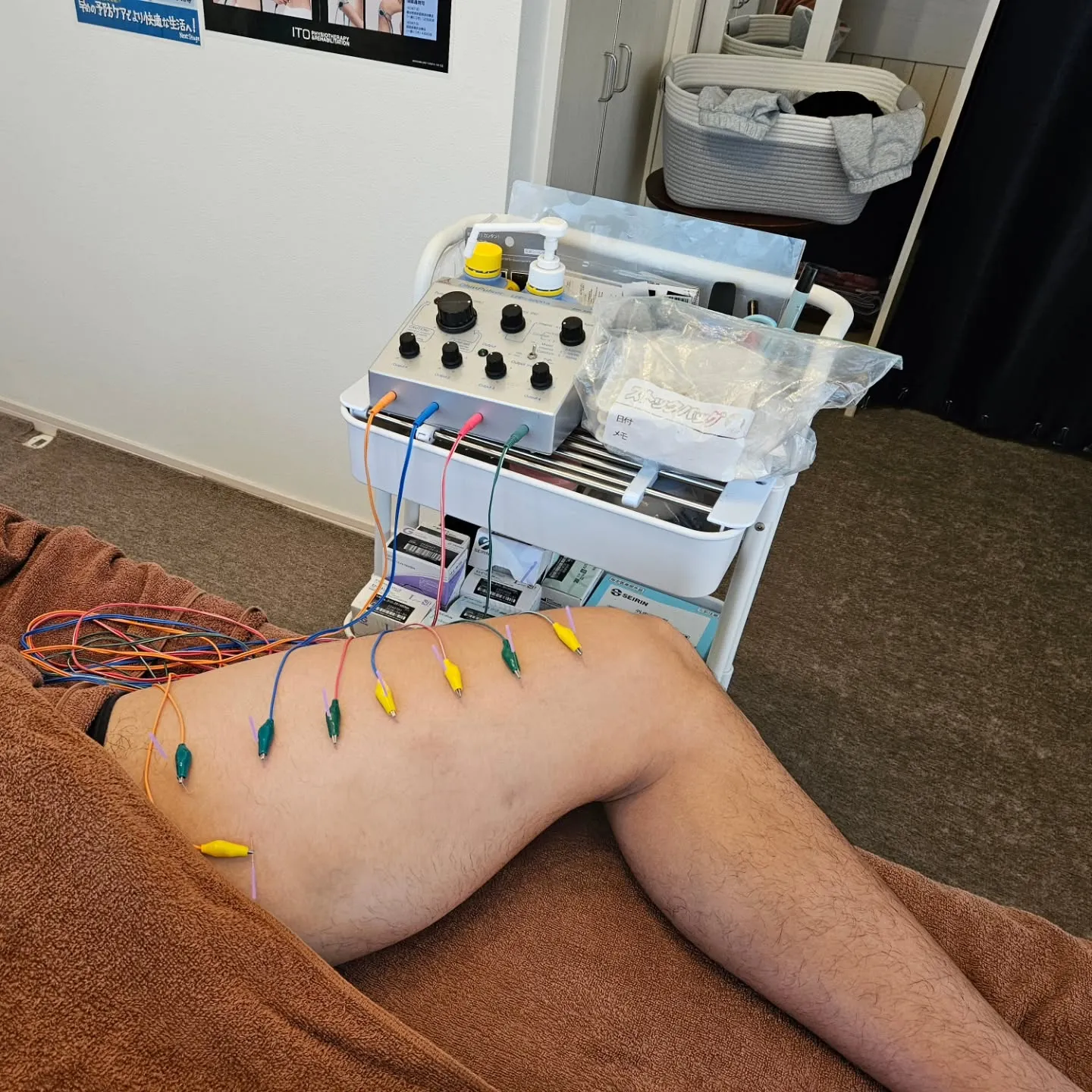 内ももの痛み治療