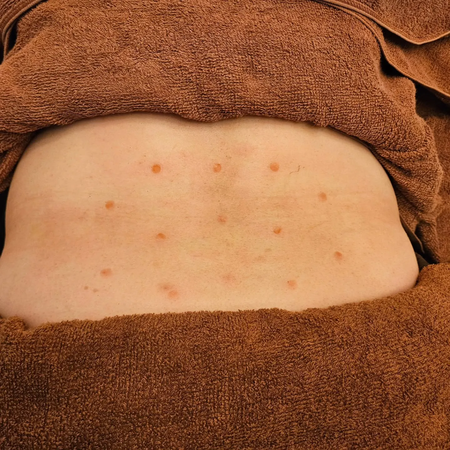 腰痛治療とバランス調整