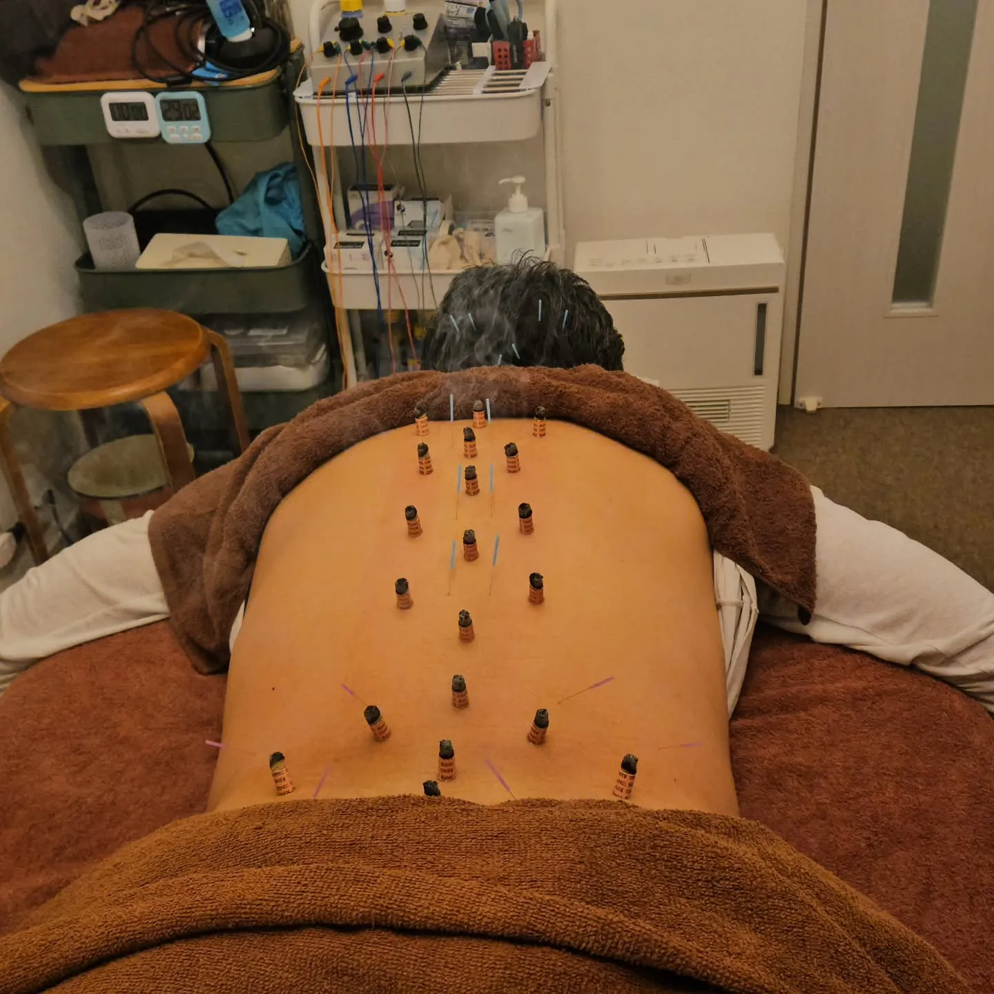 首、背中、腰の治療