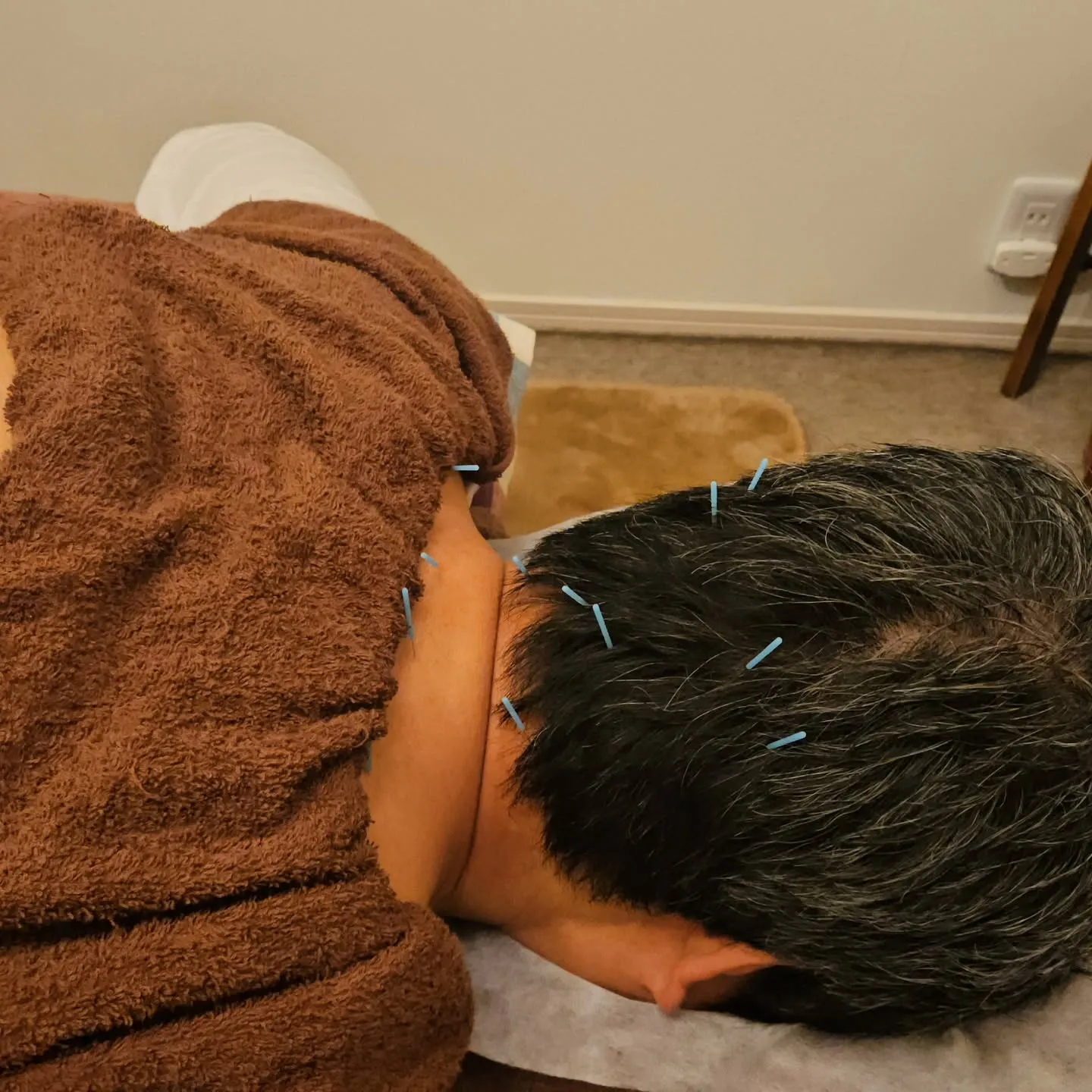 首、背中、腰の治療